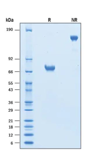 2 μg/lane Protein was resolved with SDS-PAGE under reducing (R) and non-reducing (NR) conditions and visualized by Coomassie® Blue staining.